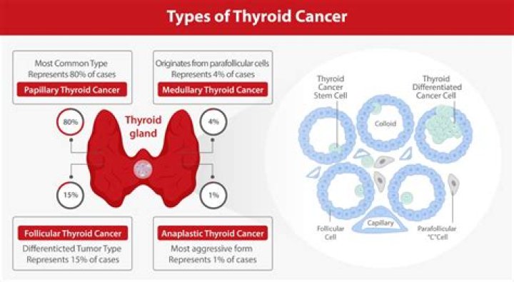 
Does Matthew Glaetzer Have Thyroid Cancer? Debunking The Online Rumor 
