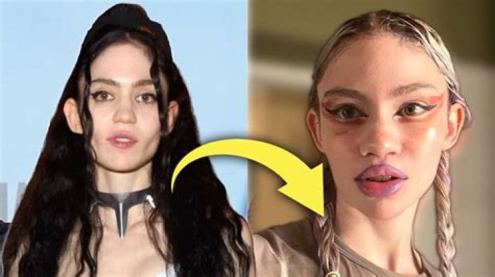 
Grimes Before and After Plastic Surgery, Who is Grimes? 