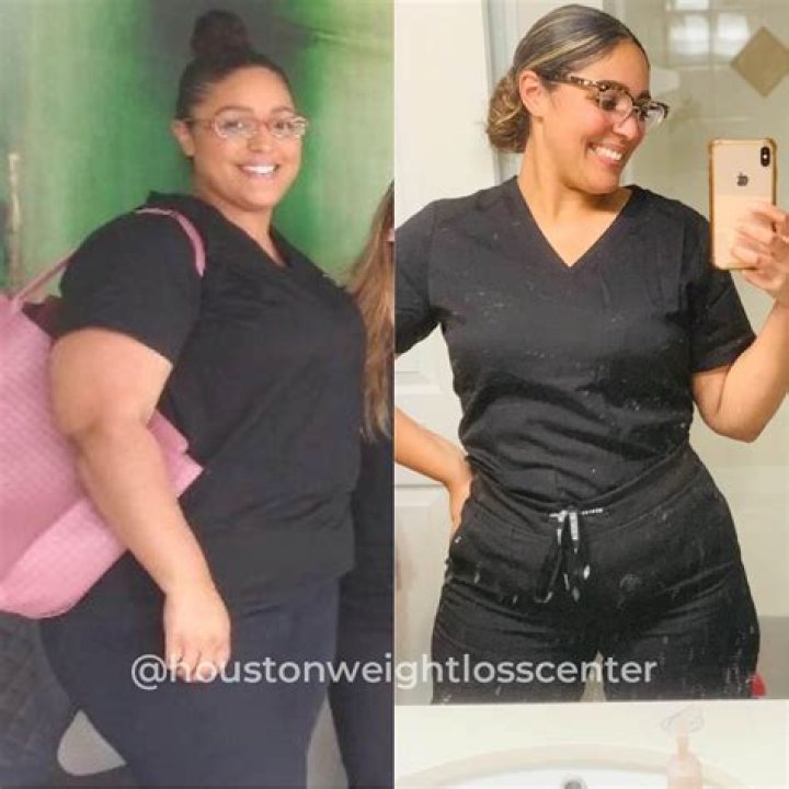 Halle Bailey Weight Loss: Before And After